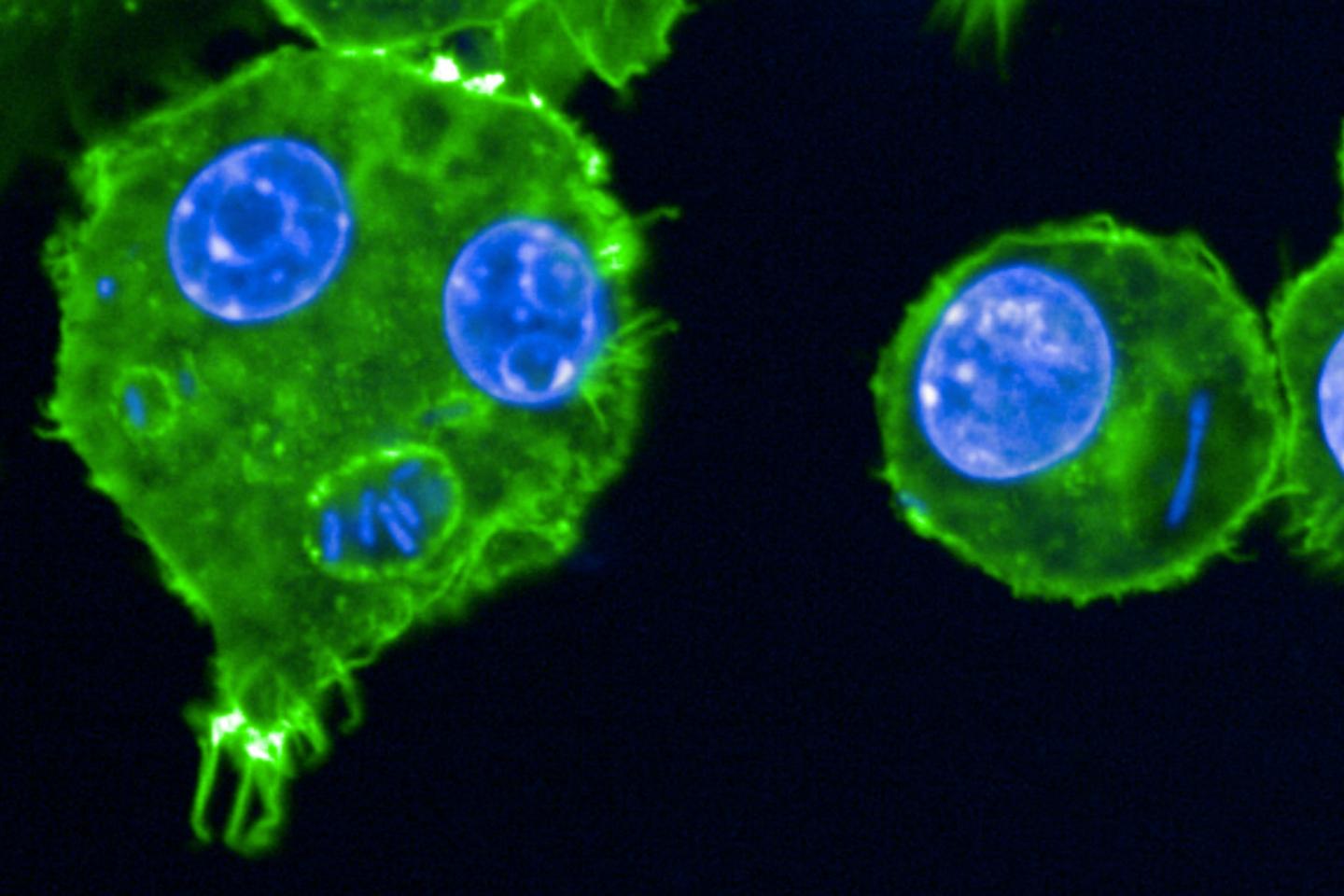 La peste, cette arme potentielle de guerre biologique