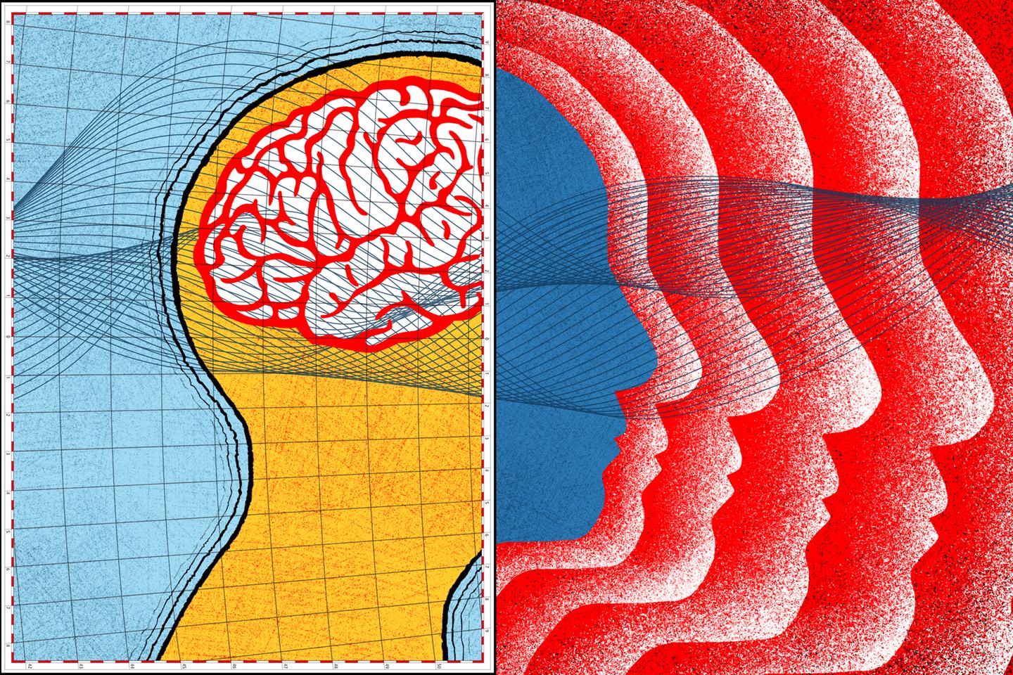 Les ultrasons à l’assaut des dépressions résistantes Les ultrasons à l’assaut des dépressions résistantes
