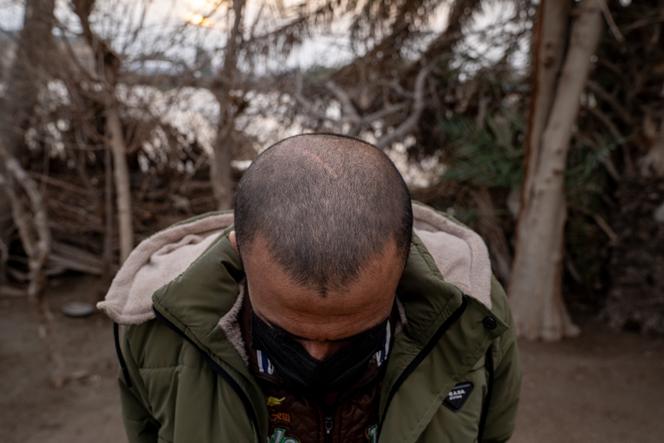 Ahmed Hussein (nom d'emprunt), 25&nbsp;ans, dont le crâne a été blessé par des coups durant des séances de torture en détention, désormais chez des proches dans le nord-est de la Syrie, le 24&nbsp;janvier&nbsp;2026.