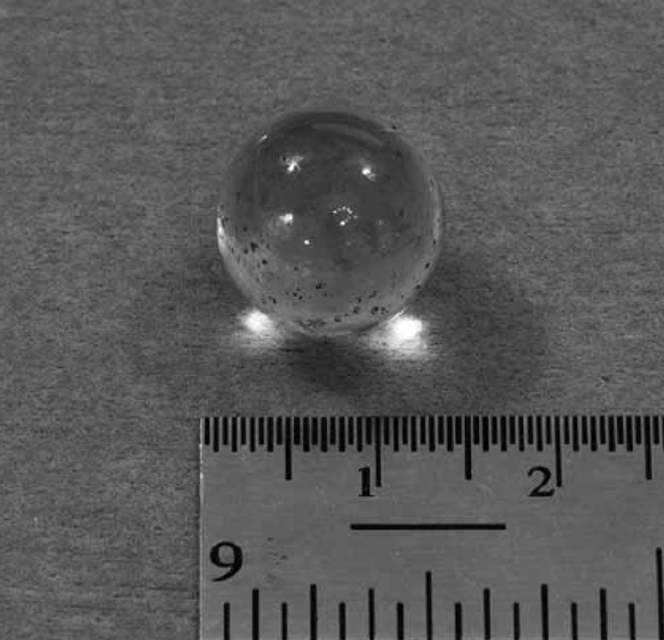 Bille de verre retrouvée dans la poche de stomie deux mois après qu’un scanner a révélé la présence d’un corps étranger.