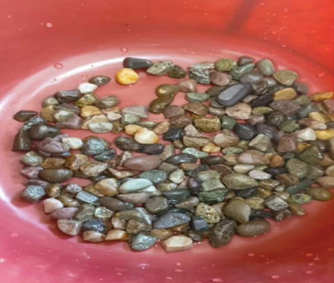 L’enfant a expulsé plus de 300 cailloux entre J1 à J7.