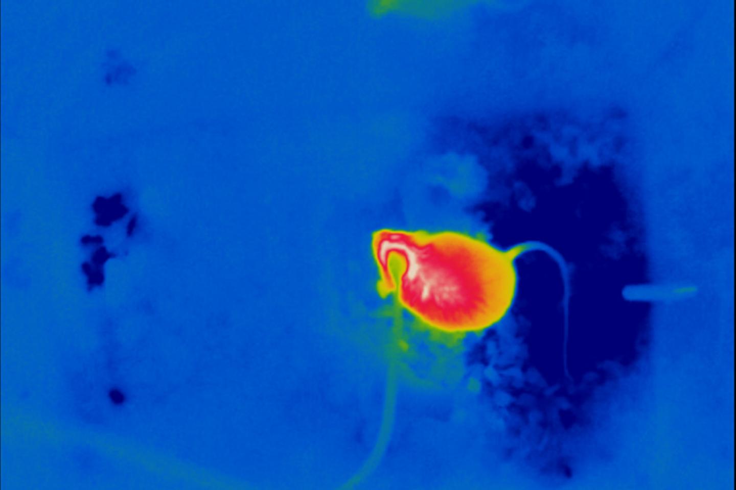 La température de la peau aurait un lien avec le déclenchement des crises de narcolepsie