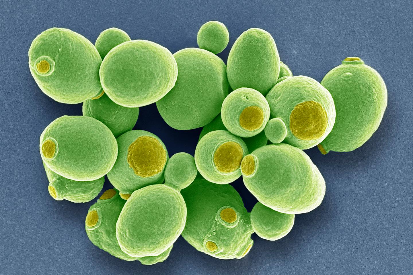 L’inattendu destin des levures domestiques