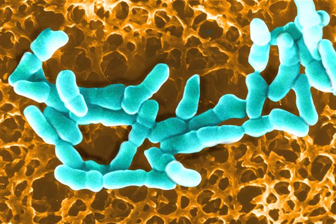 Bactérie « Gardnerella vaginalis », image réalisée au microscope à balayage électronique x 15 000.