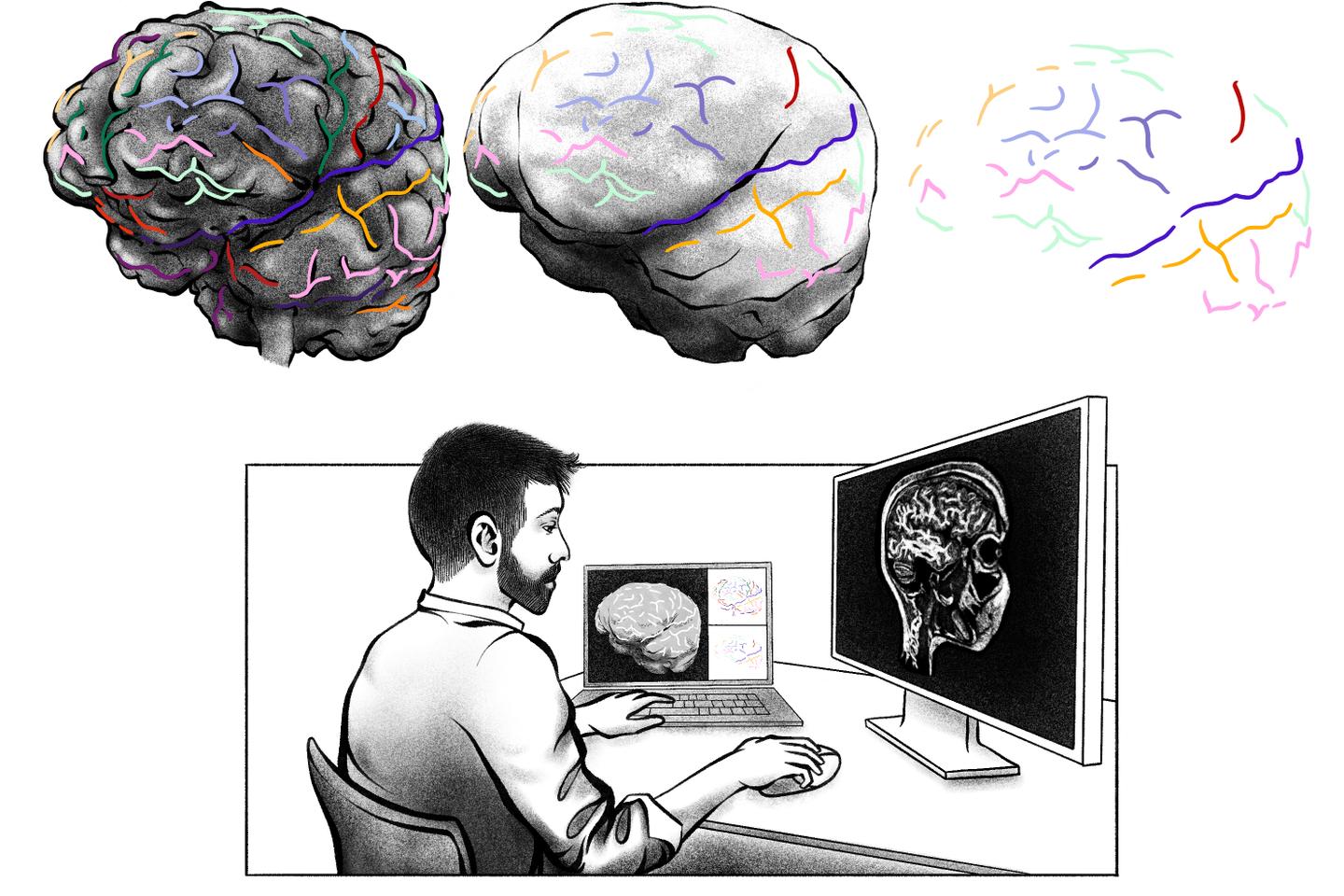 Notre crâne ne renvoie pas un reflet fidèle de l’anatomie de notre cerveau