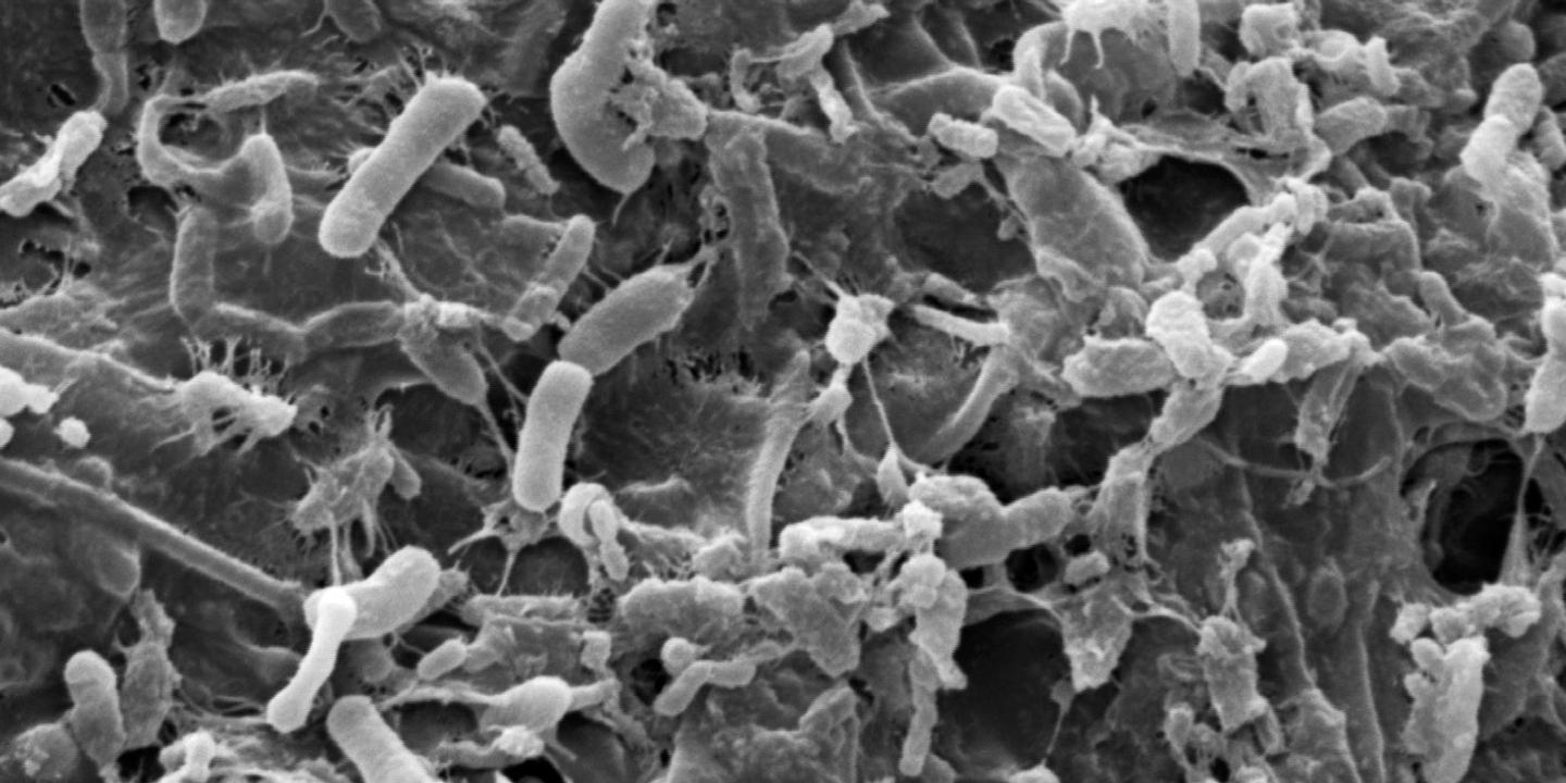 Pesticides : l'impact méconnu sur la vie microbienne essentielle des sols