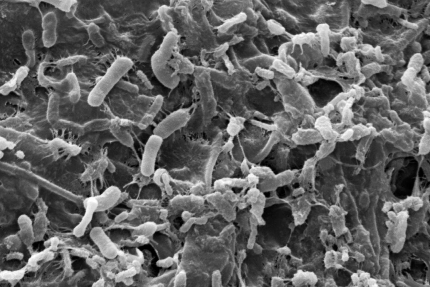 L’usage de pesticides bouleverserait en profondeur la biodiversité microbienne des sols L’usage de pesticides bouleverserait en profondeur la biodiversité microbienne des sols