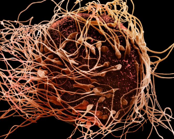 Micrographie électronique à balayage de spermatozoïdes humains fécondant un ovule in vitro. 