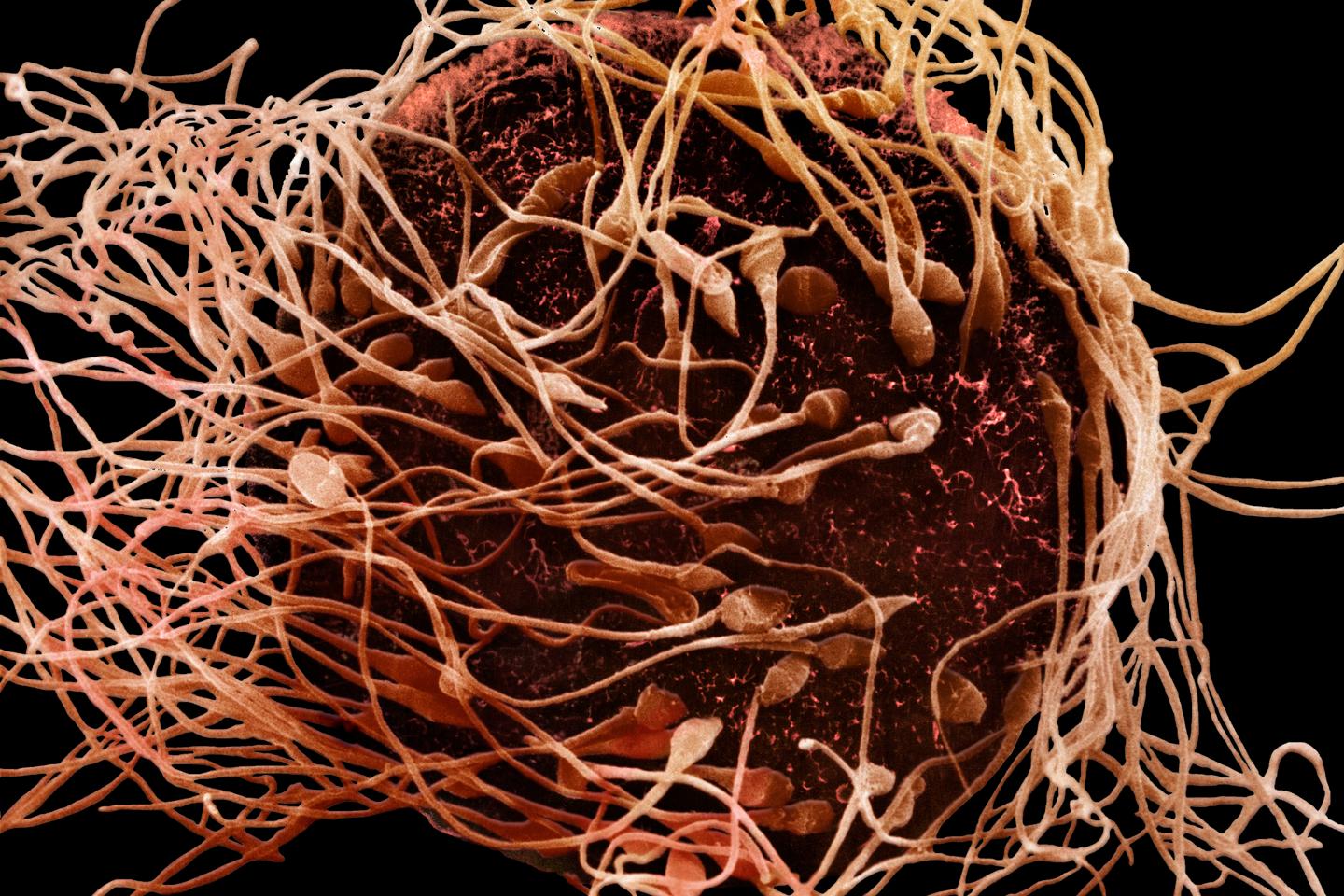 La piste des anticorps comme moyen de contraception