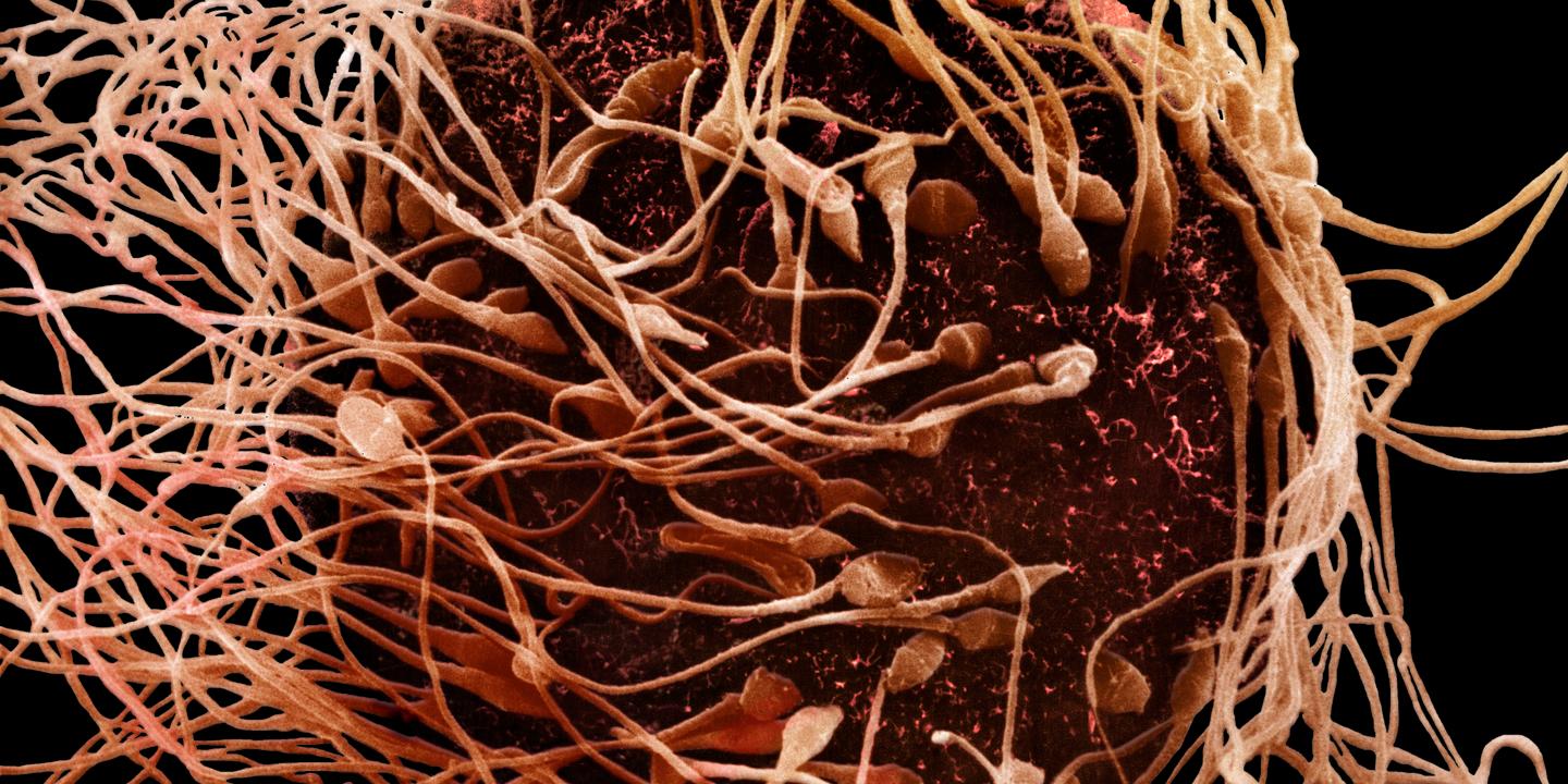 Les anticorps, une nouvelle voie prometteuse pour la contraception masculine