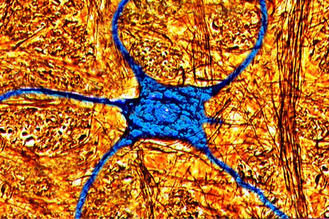 Vue d’un neurone humain au microscope optique numérique, en 2001.