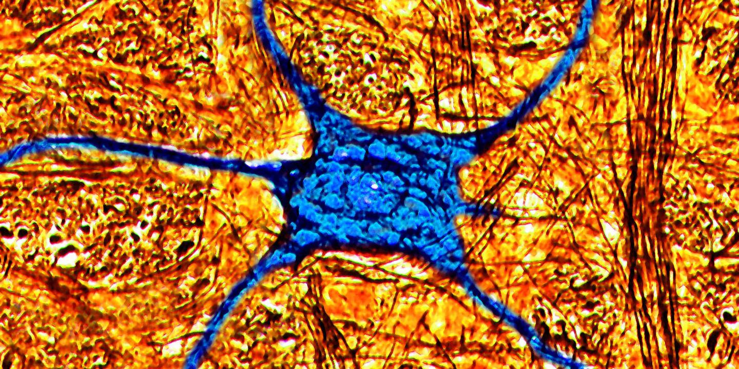Le cerveau des octogénaires peut encore fabriquer de nouveaux neurones