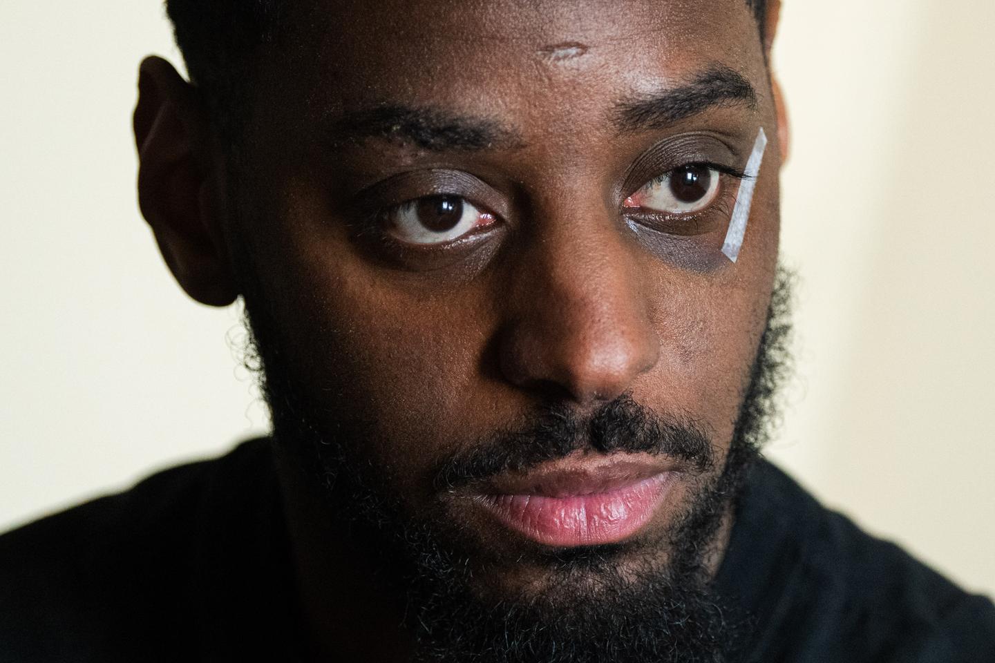 Le témoignage de Flavel, victime de violences policières à Noisiel dans la nuit du 16 mars : « S’il n’y avait pas eu de vidéos, on ne m’aurait jamais cru »