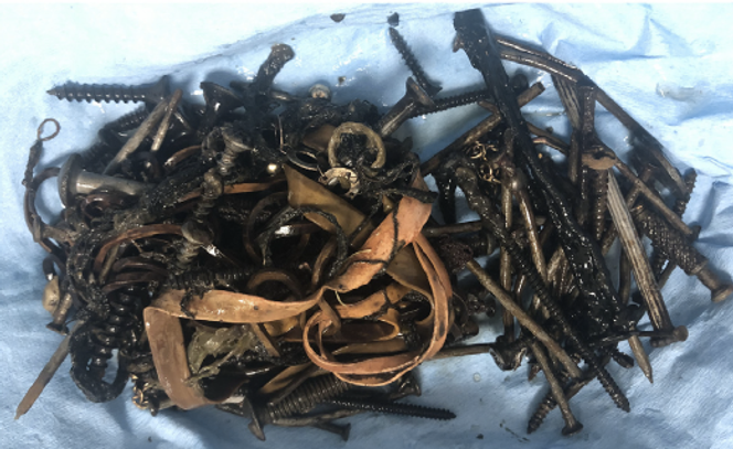 Des clous métalliques, des élastiques et des épingles de sûreté ont été extraits de l’estomac et du côlon (cæcum).