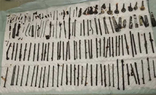 De nombreux corps métalliques ont été extraits de l’estomac.