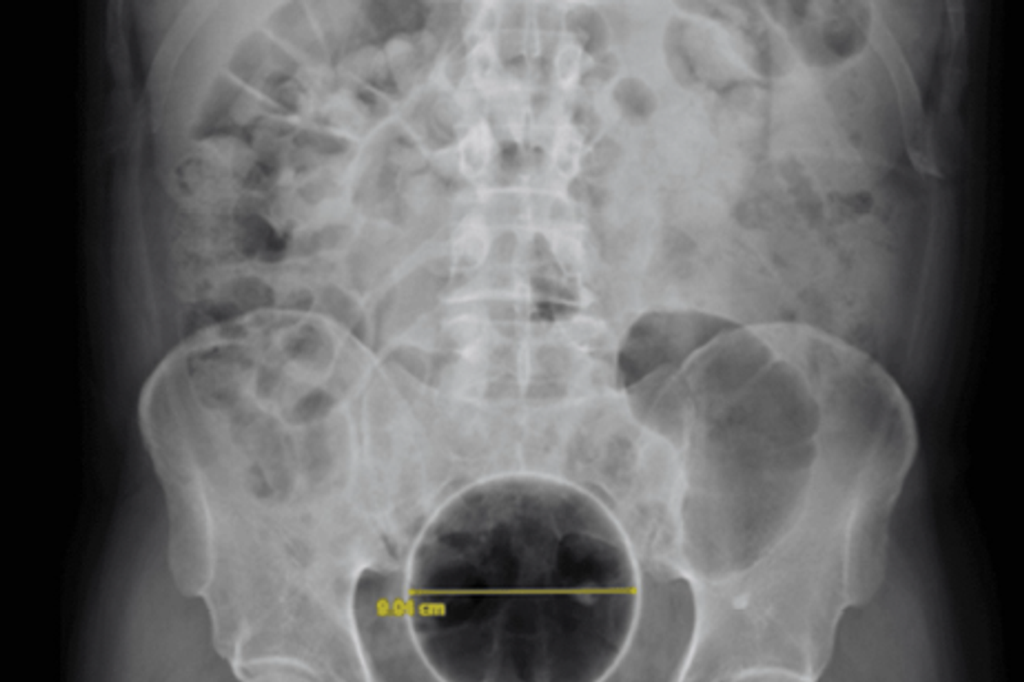 chronique d’un patient habitué du bloc opératoire