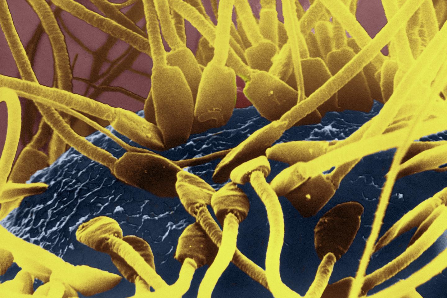 Ejaculer plus souvent améliorerait la qualité du sperme