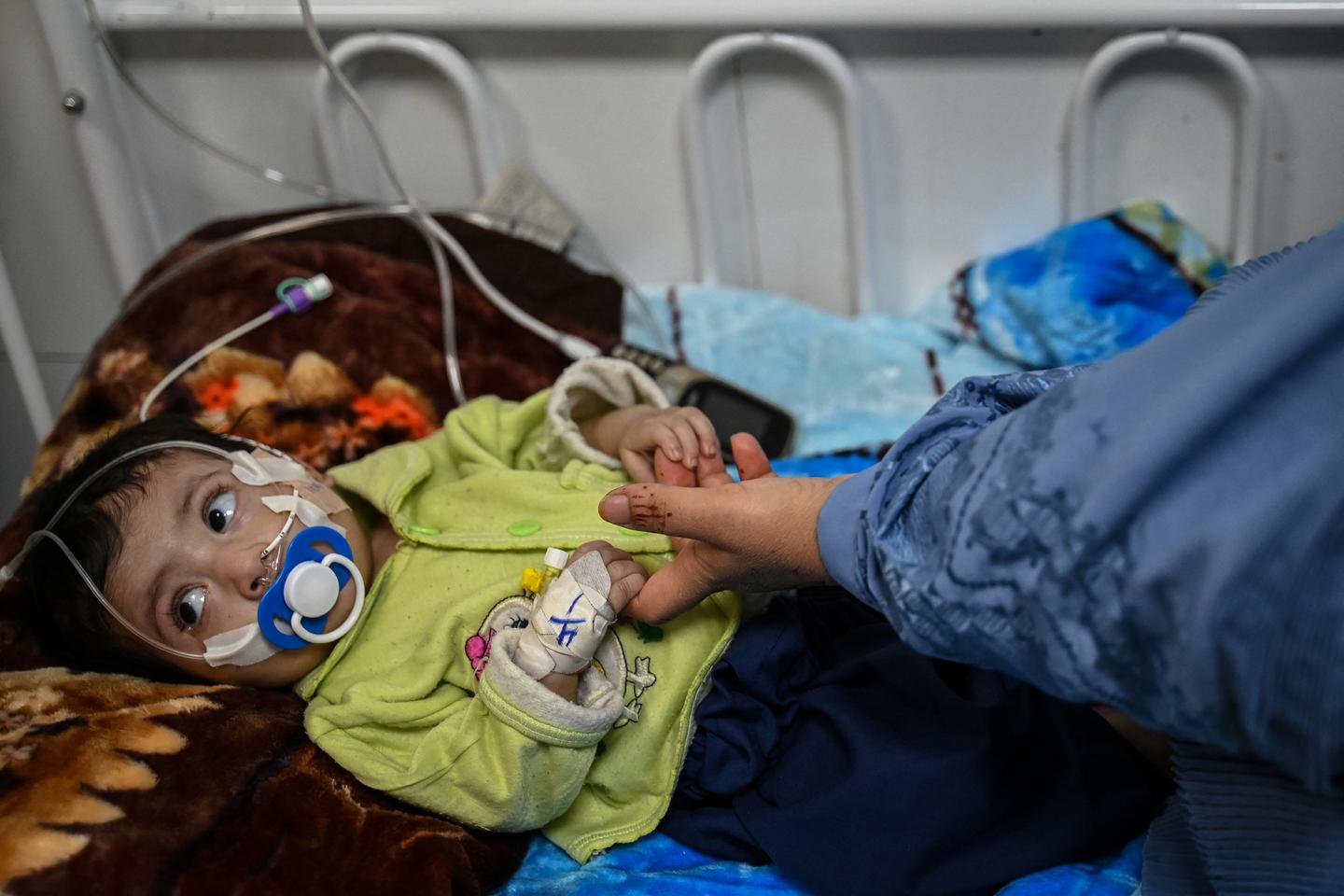 La lutte contre la malnutrition, victime des crises internationales et du recul des financements