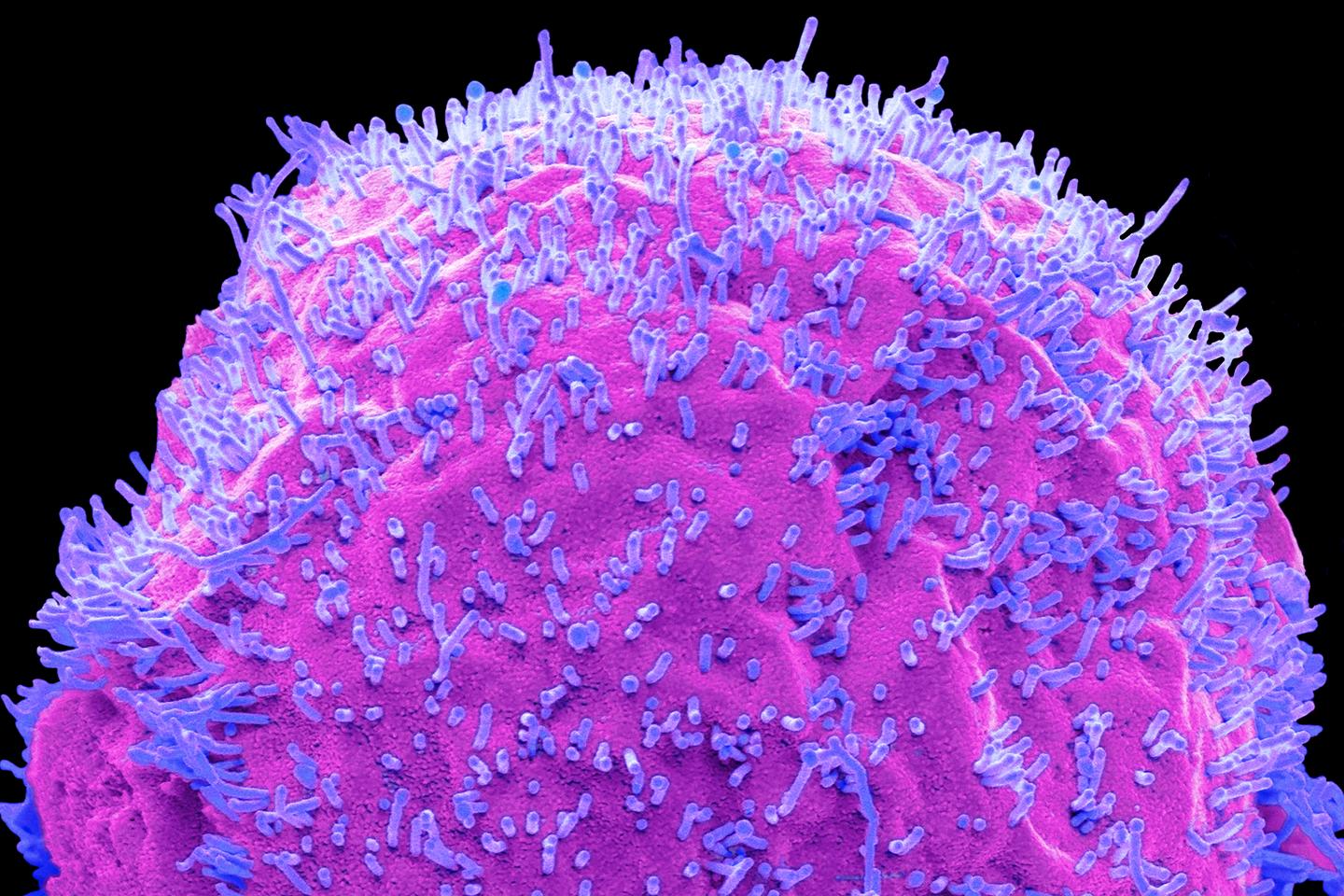 Grippe : ces « ruses » qui rendent le virus plus nocif