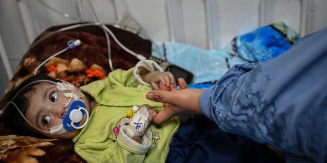 La lutte contre la malnutrition, victime des crises internationales et du recul des financements