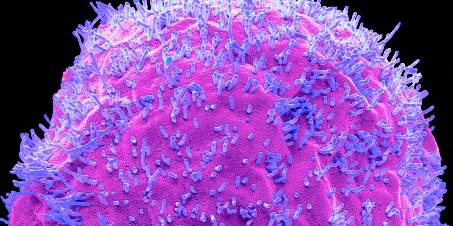 Grippe : les mécanismes sournois qui amplifient la nocivité du virus