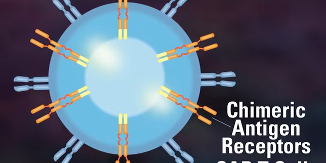 Chez une patiente, une perfusion de cellules CAR-T induit la rémission de trois maladies auto-immunes