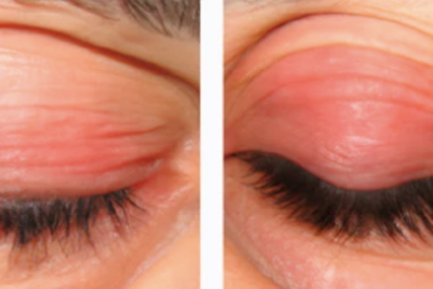 Quand une maladie inventée piège l’intelligence artificielle et s’invite dans une revue médicale