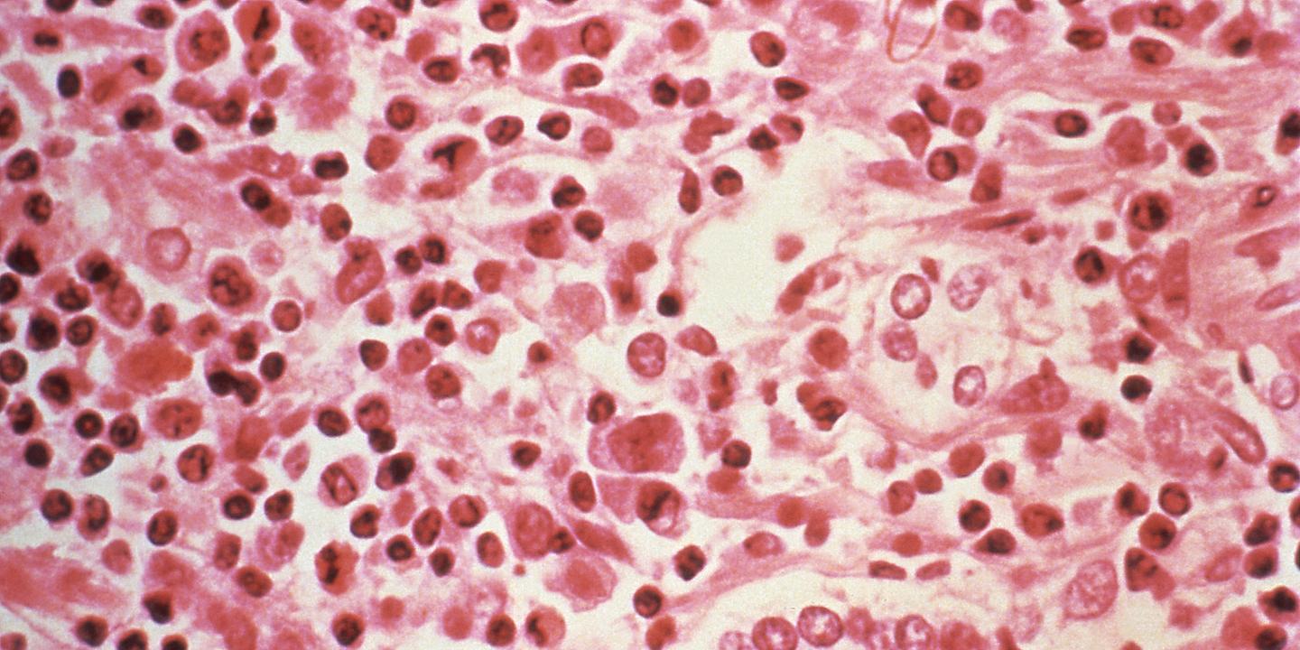 Hantavirus : origine, transmission, symptômes, ce qu'il faut savoir