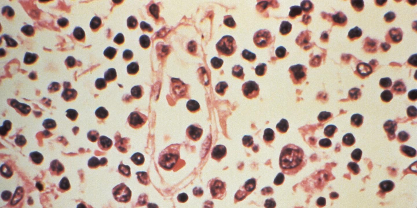 Hantavirus : lexique pour comprendre la souche Andes et son taux de létalité