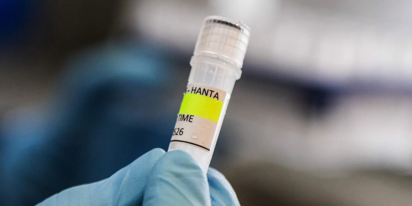 Hantavirus : que sait-on sur cette famille de virus ?