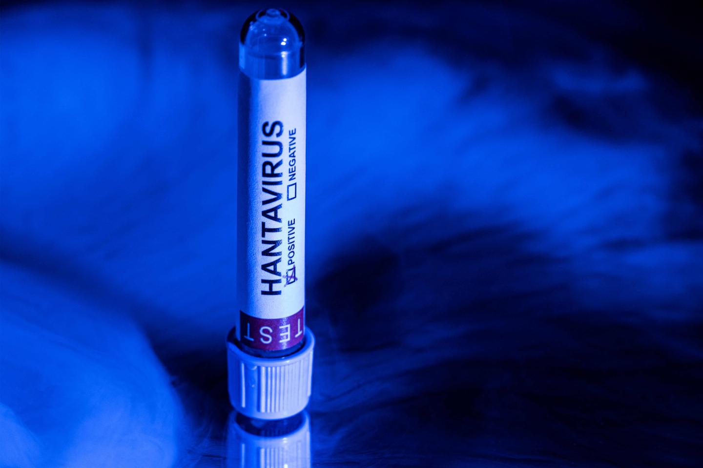 Hantavirus : les réseaux sociaux, ces hôtes de plus en plus adaptés à la désinformation médicale