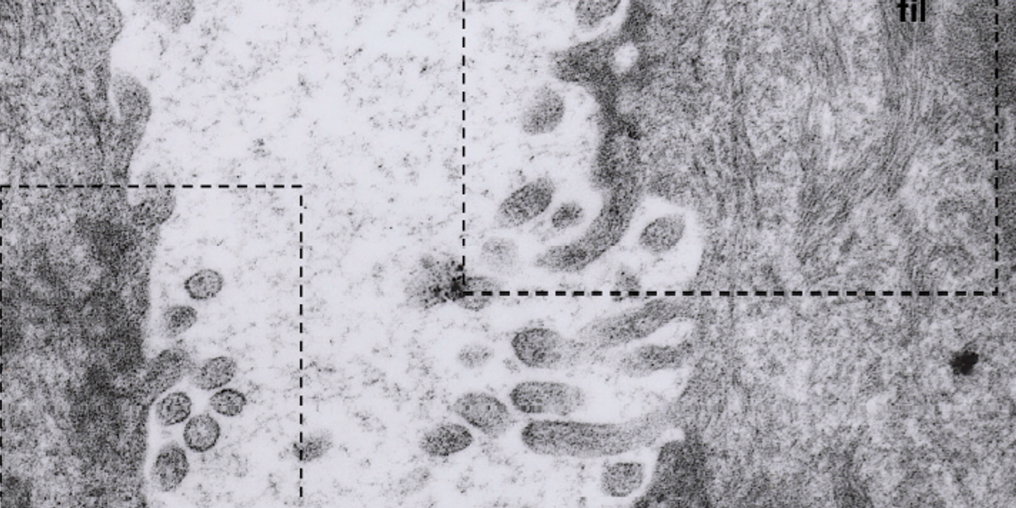 Histoire du mystérieux hantavirus des Andes