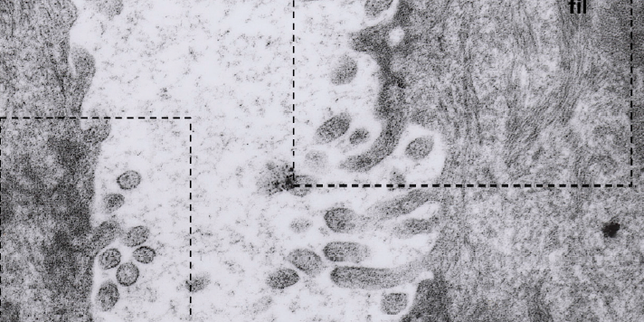 Une brève histoire de l’ANDV, le mystérieux hantavirus des Andes