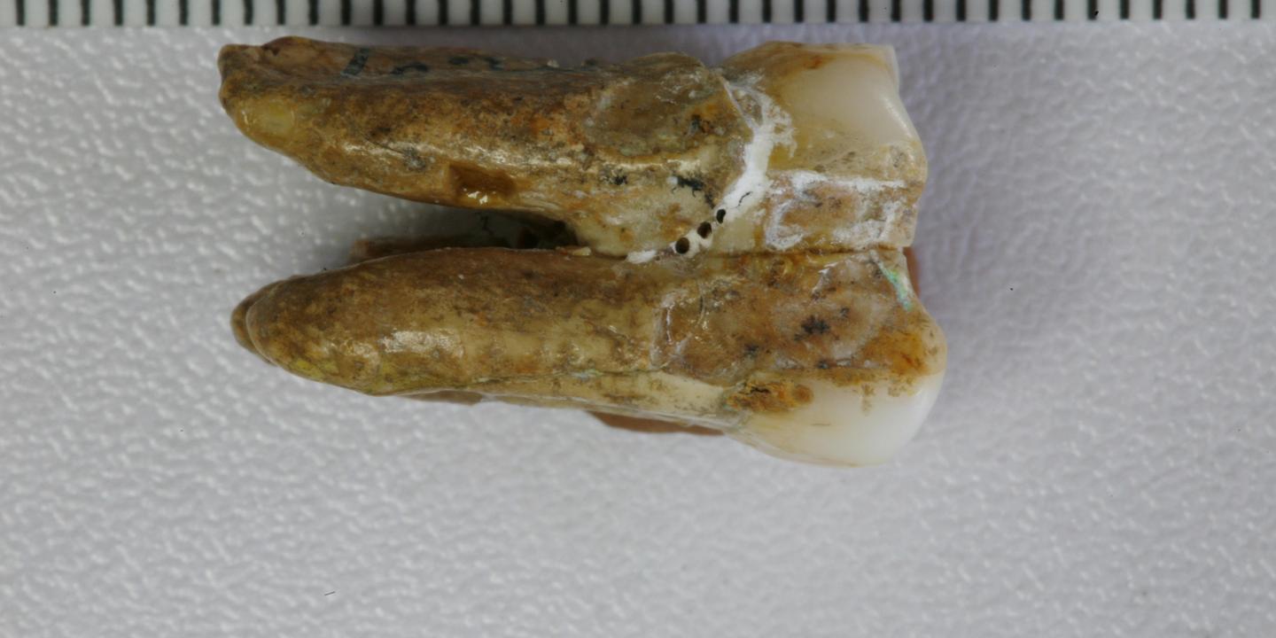 Un email de dents vieilles de 400 000 ans révèle des croisements d'hominines