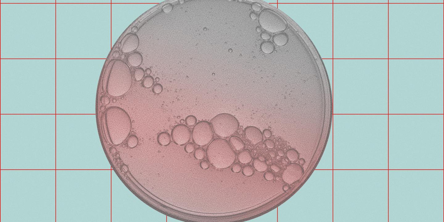 Immunothérapies des cancers : quand peut-on les arrêter ?
