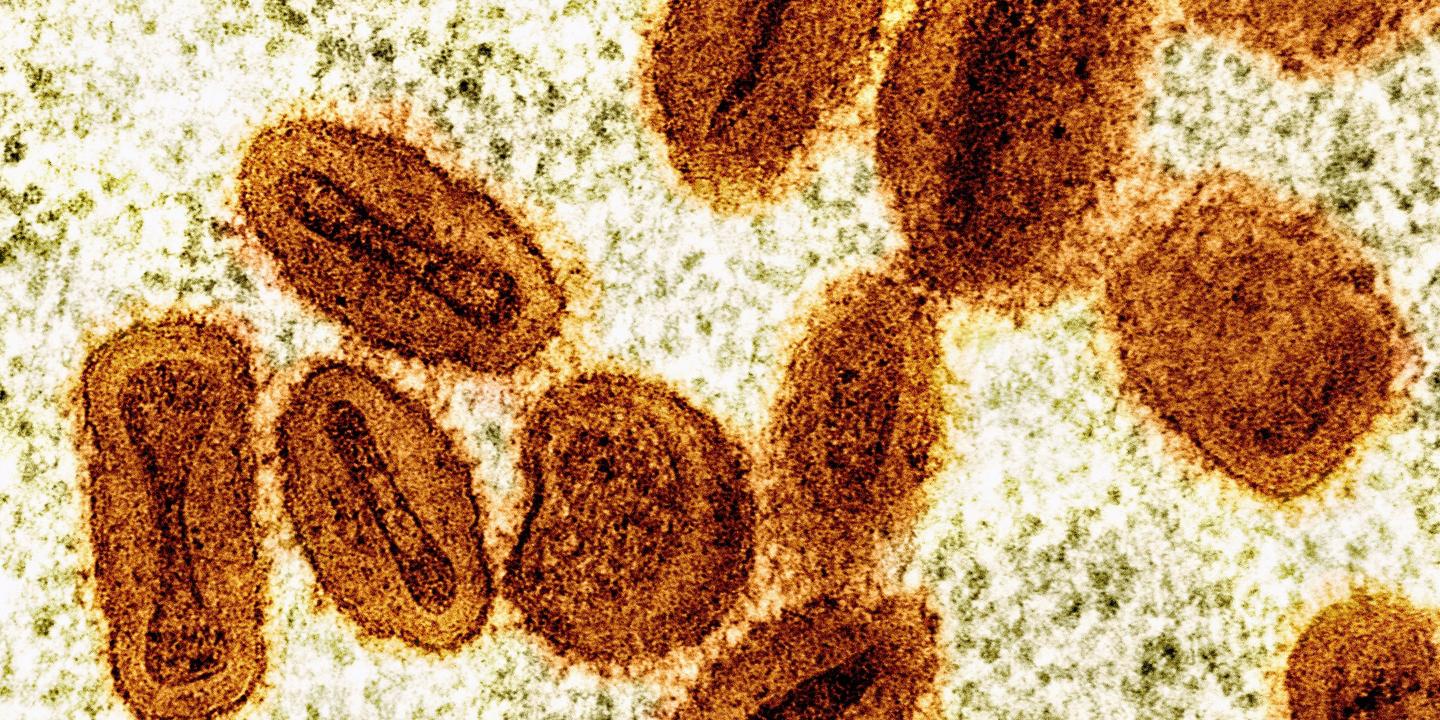 Deux virologues inculpés aux États-Unis pour importation illégale de monkeypox