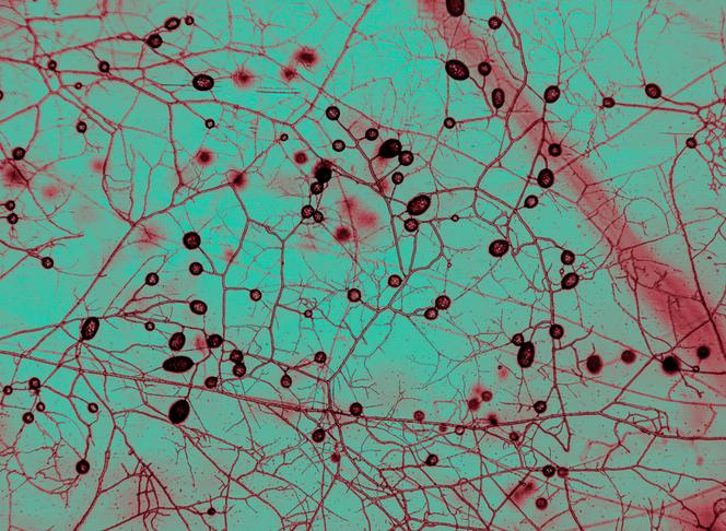 Champignons mycorhiziens observés au microscope Morrison à l’Institut Amolf des matériaux complexes, à Amsterdam, le 12 septembre 2025. Les structures circulaires sont des spores.
