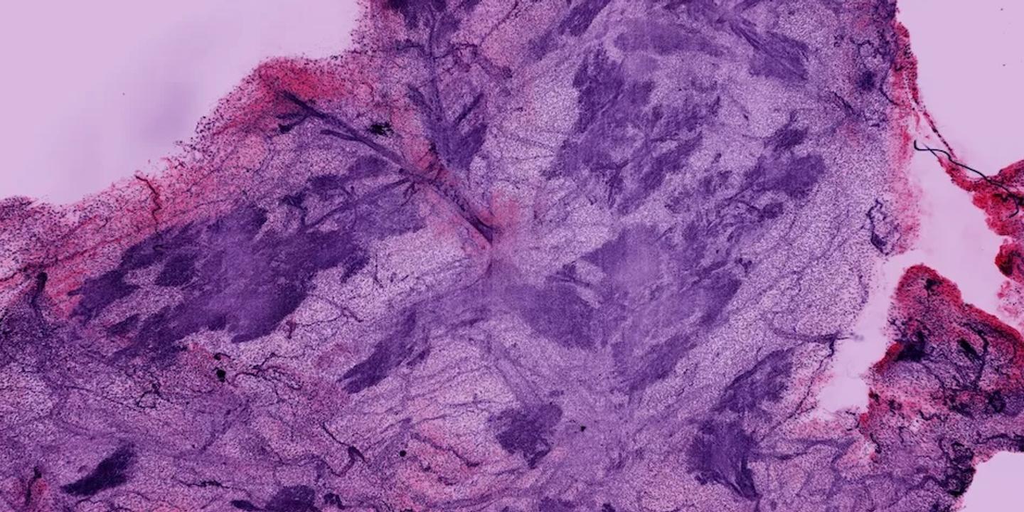 Microscopie 3D : une révolution pour l'analyse des tissus biologiques