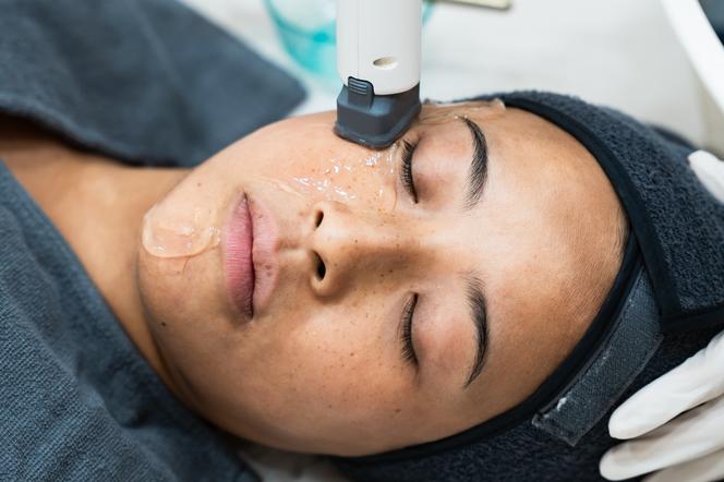 Pendant la séance de Xerf, la praticienne déplace l’appareil sur le visage de Mélanie B. Le derme est chauffé en profondeur pour stimuler la production de collagène, dans la clinique dermatologique Relieve, à Séoul, le 17 août 2026. - SUH JEEN MOON POUR « LE MONDE »