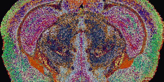 Dans le cerveau, il y a beaucoup de gras : la preuve par l’image